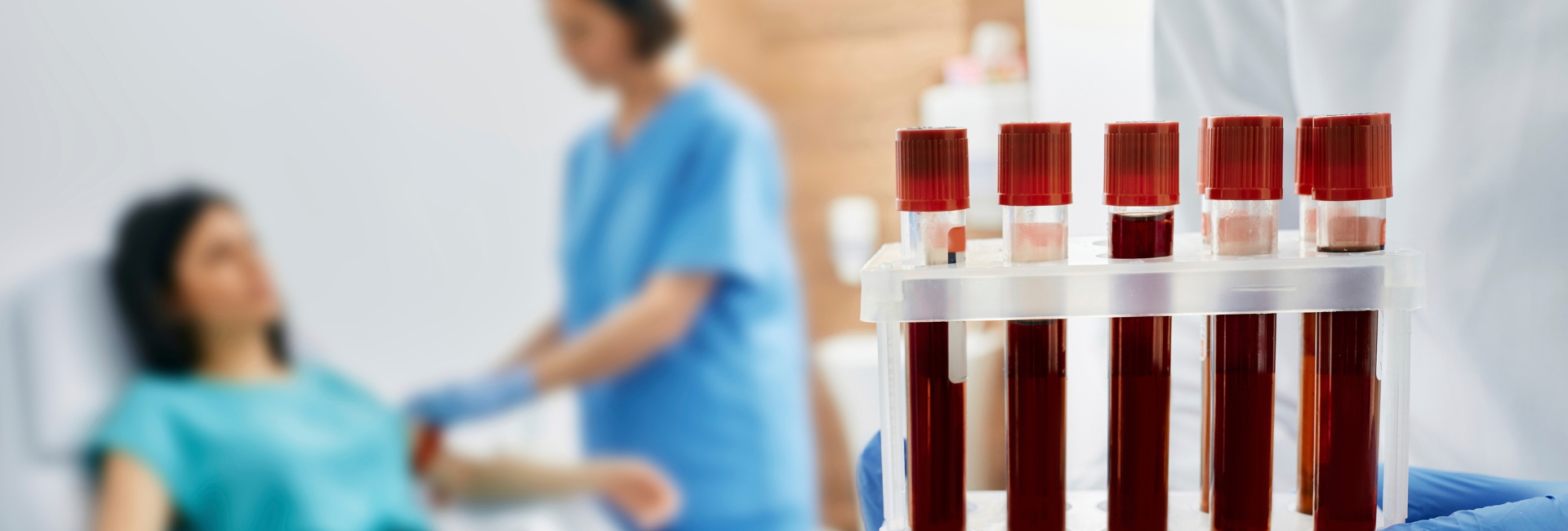 Laboratorio di analisi per esami del sangue a Napoli